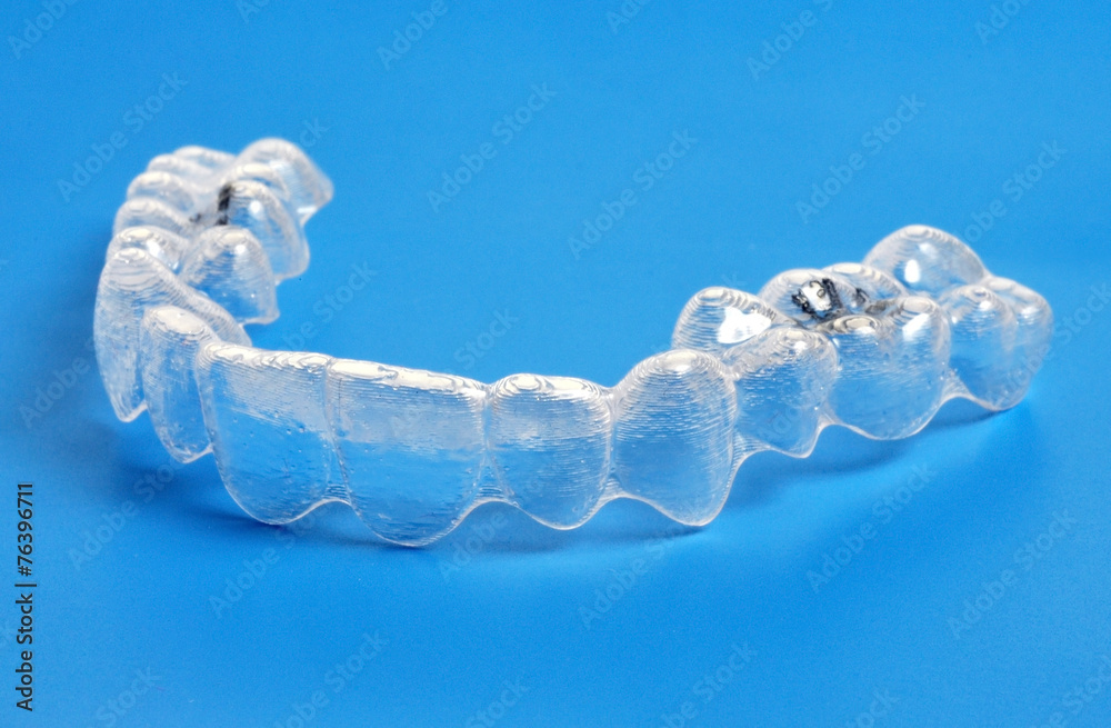 Invisible braces Invisible braces