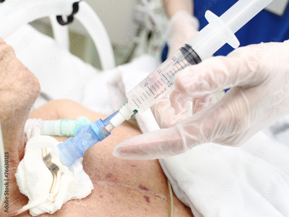 Medical (Nursing) service seriously ill patients in the ICU Medical (Nursing) service seriously ill patients in the ICU