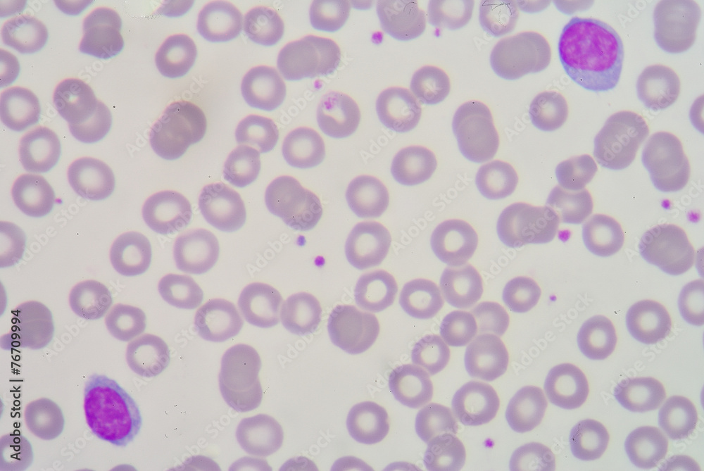 lymphocyte lymphocyte