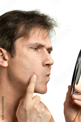 Φωτογραφία Men squeezing a pimple
