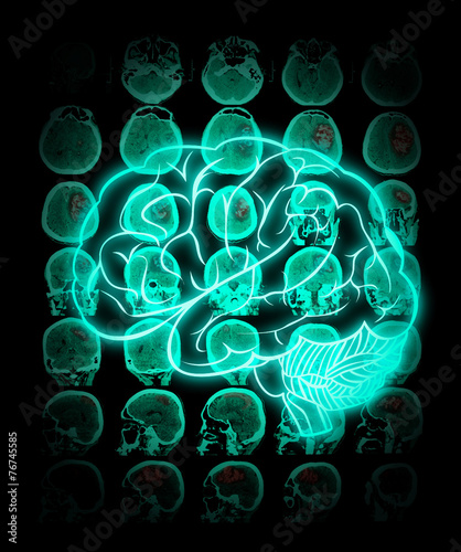 Fototapeta Naklejka Na Ścianę i Meble -  uman brain against the background of CT scan