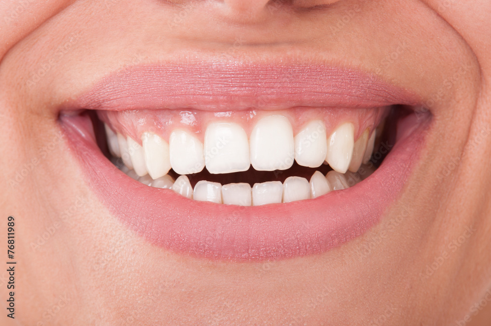 Close-up of perfect female teeth smiling Close-up of perfect female teeth smiling