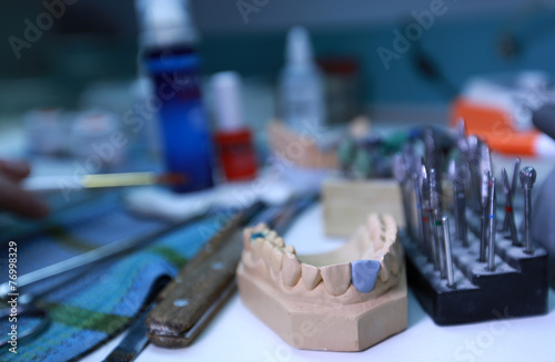 Denture cast in plaster for the dentist
