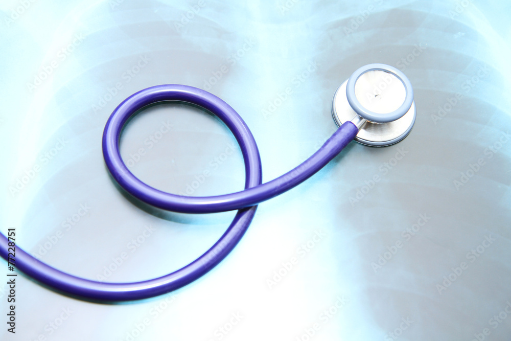 Close up image of stethoscope on x-ray film Close up image of stethoscope on x-ray film