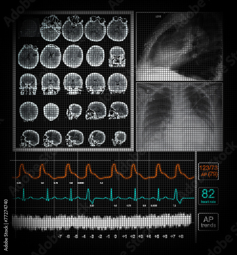 Displey with the functions of the patient
