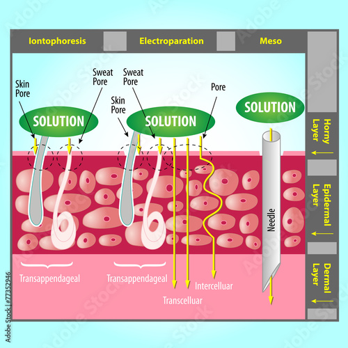 Transdermal Delivery photo