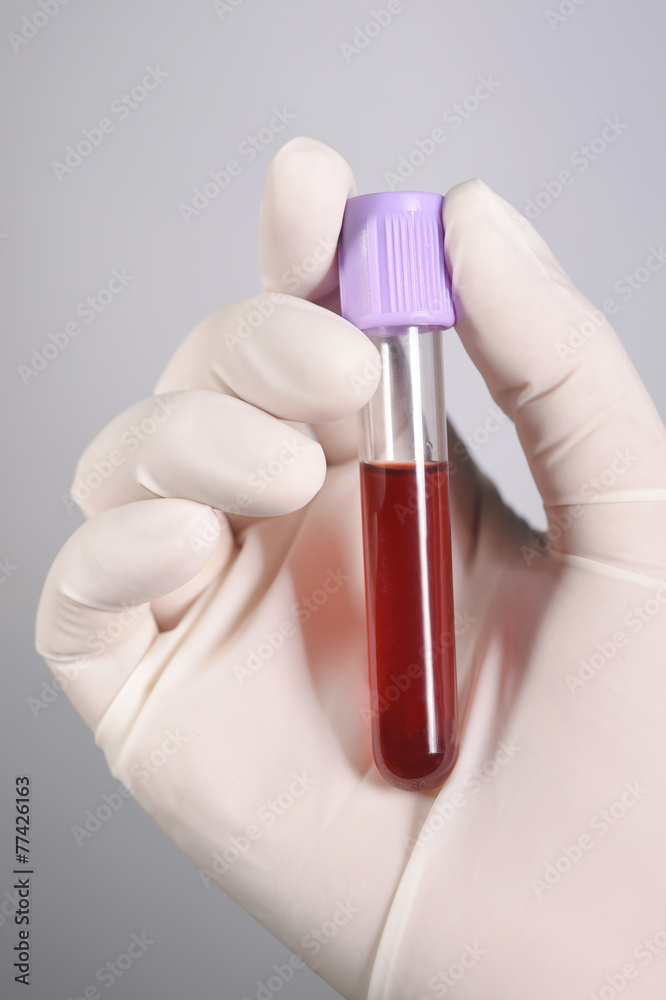 Hand holding blood in test tube on gray background Hand holding blood in test tube on gray background