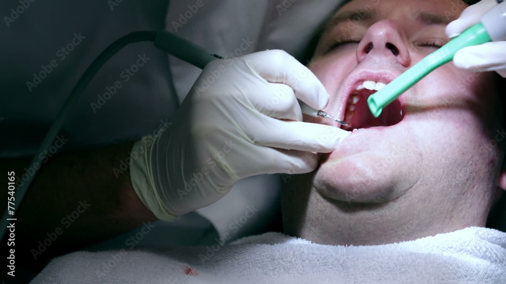 Dentist treats his client with the dental tools