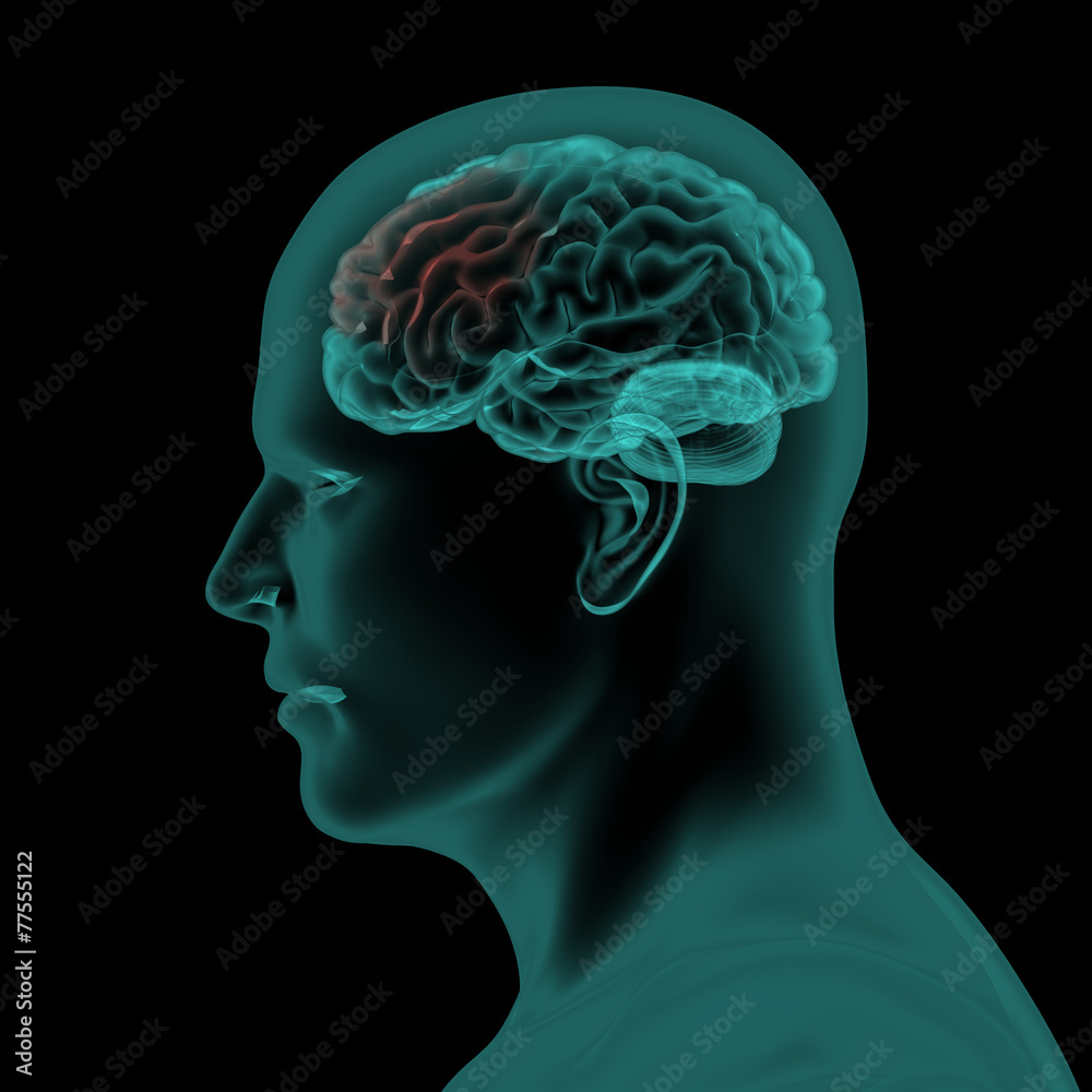 Lateral x-ray scan view of human head and brain Stock Illustration ...