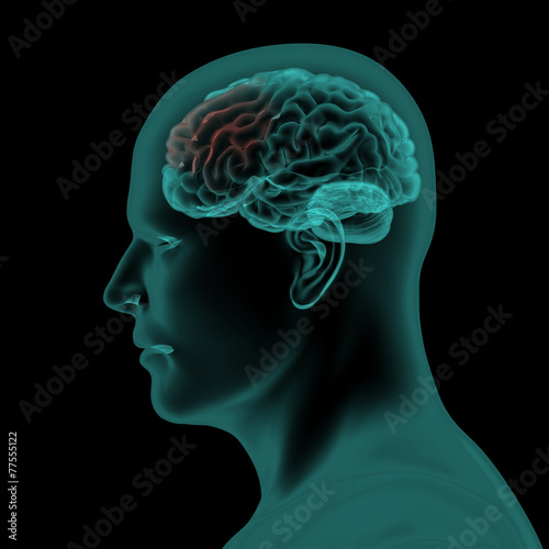 Lateral x-ray scan view of human head and brain