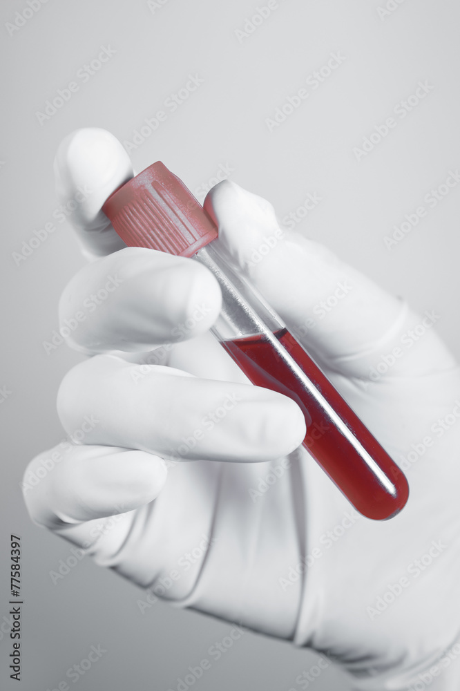 Hand holding blood in test tube on gray background Hand holding blood in test tube on gray background