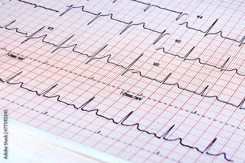 electrocardiogram on white background