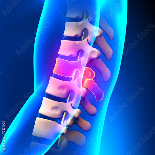 T10 Disc - Thoracic Spine Anatomy photo