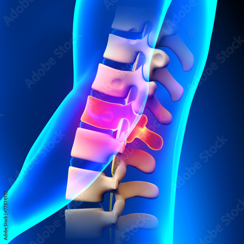 T12 Disc - Thoracic Spine Anatomy photo