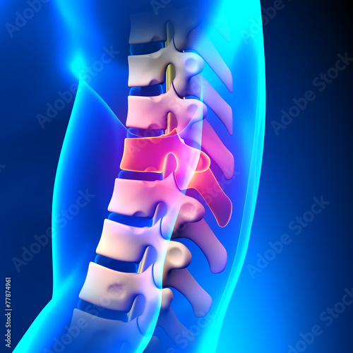 T8 Disc - Thoracic Spine Anatomy photo