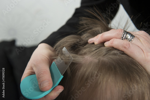 Checking for lice