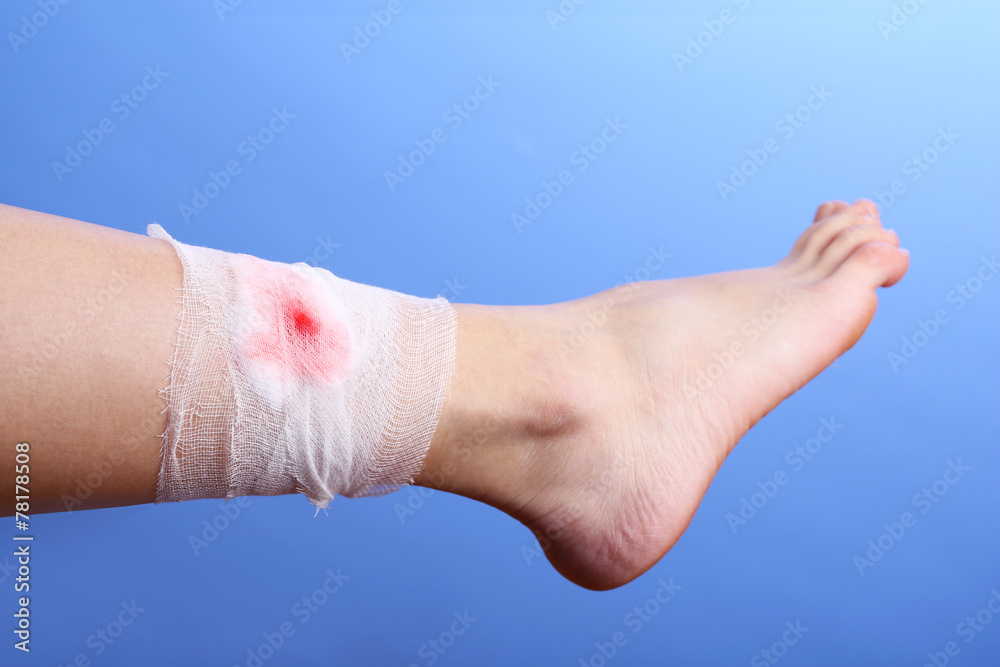 Wounded leg with bandage on blue background Photos | Adobe Stock