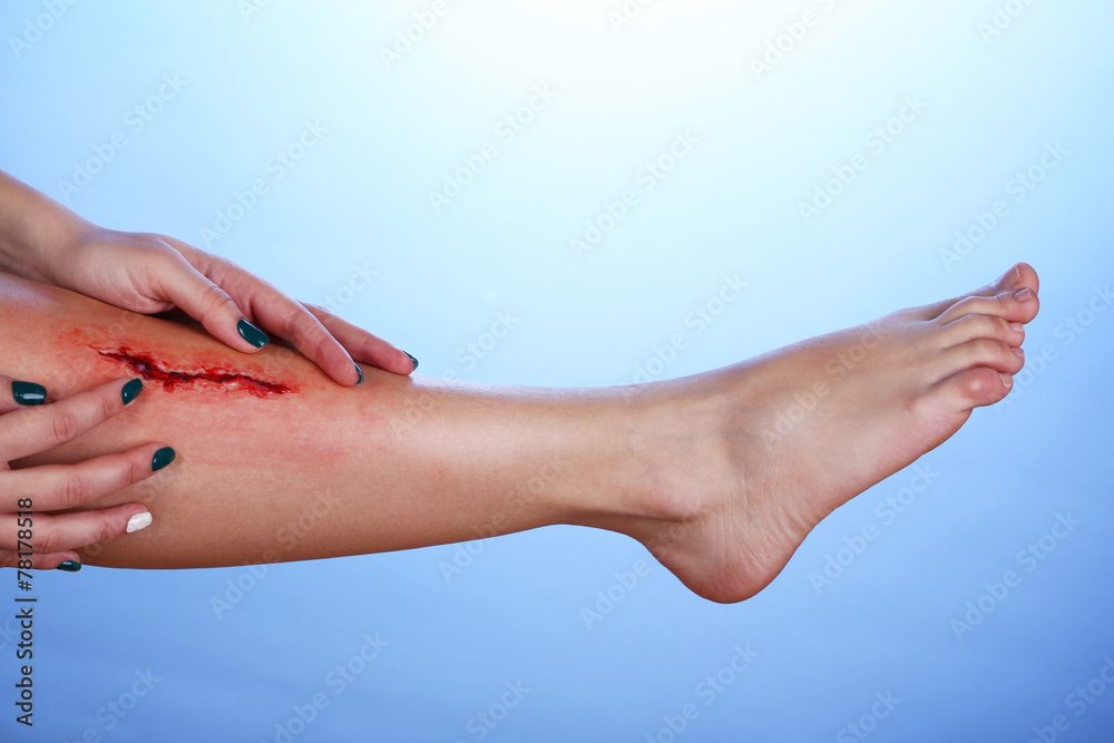 Injured leg with blood on blue background