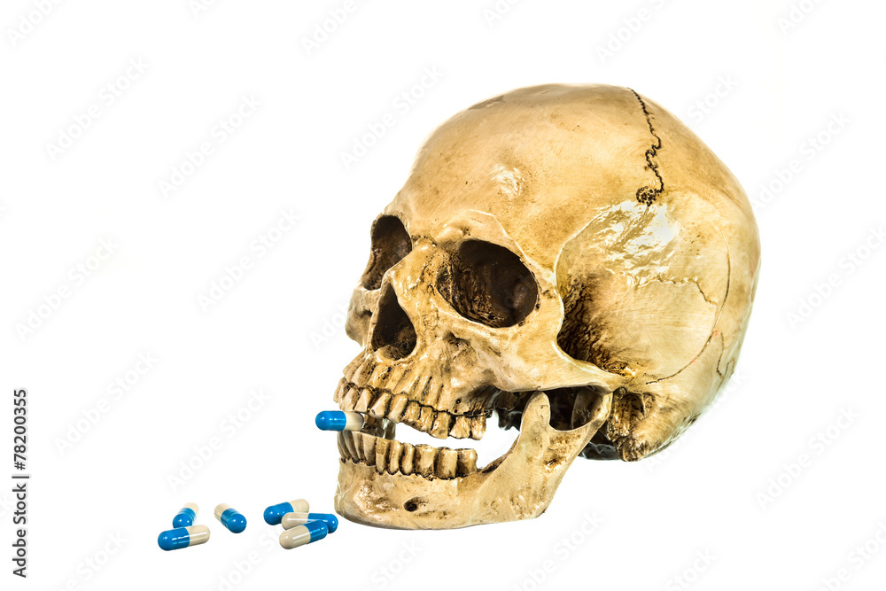 Side view of human skull with pill in teeth Side view of human skull with pill in teeth