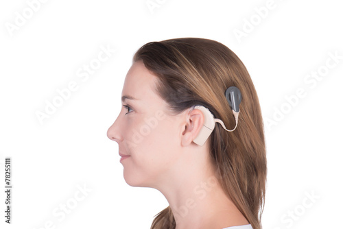Young woman with cochlear implant photo