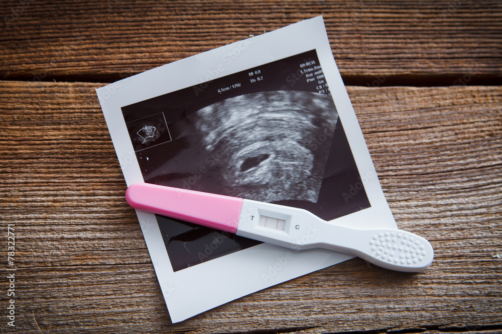 pregnancy test - obrazy, fototapety, plakaty 