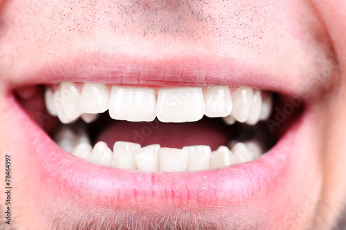 Smiling man after visit dentist om blurred background, macro