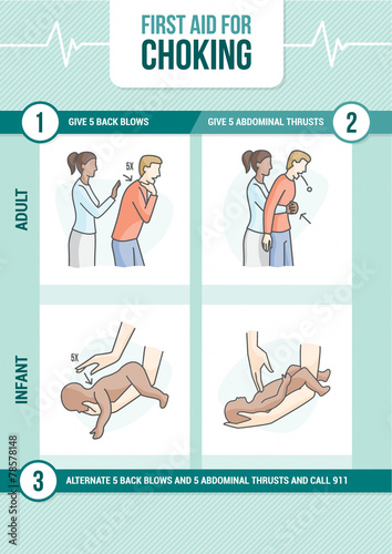 Choking first aid photo