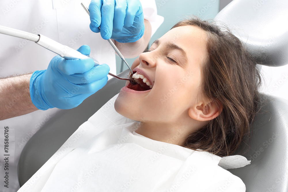Leczenie zęba, stomatolog czyści ubytek - obrazy, fototapety, plakaty 