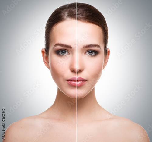 Face before and after retouch