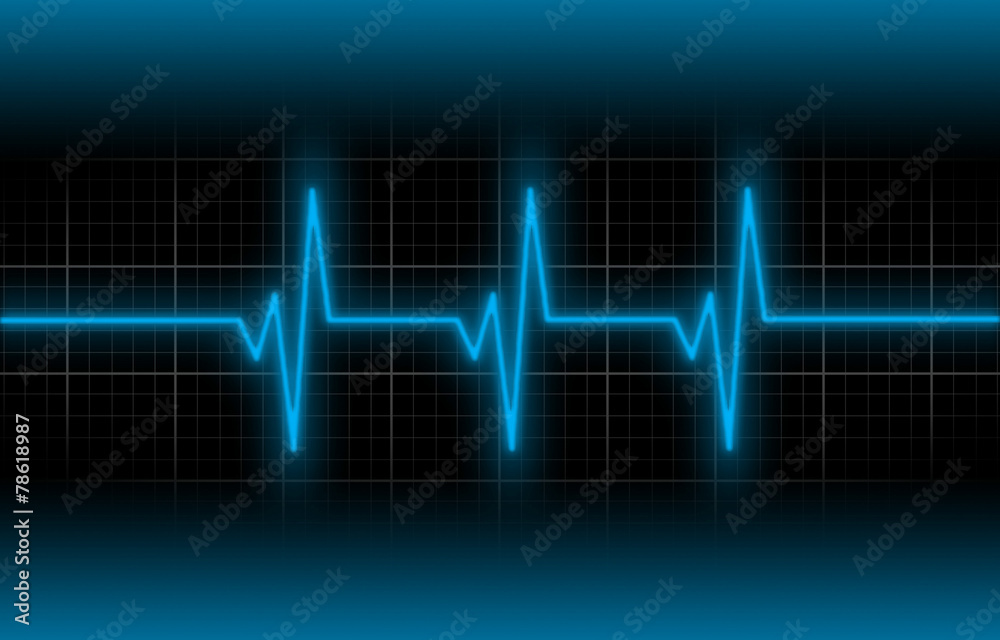 Electrocardiogram - Concept of healthcare
