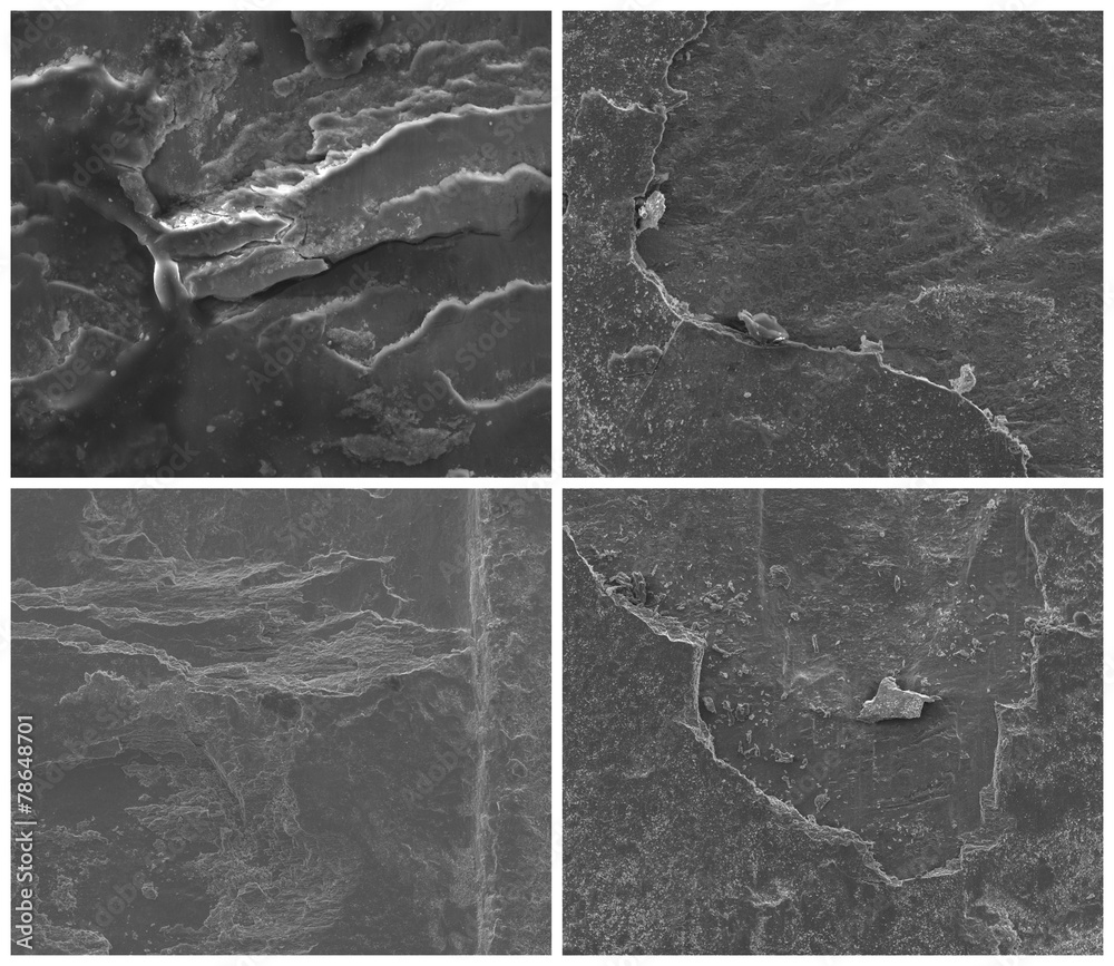 SEM images of steel SEM images of steel