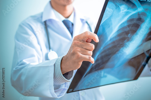 close up of male doctor holding x-ray or roentgen image photo