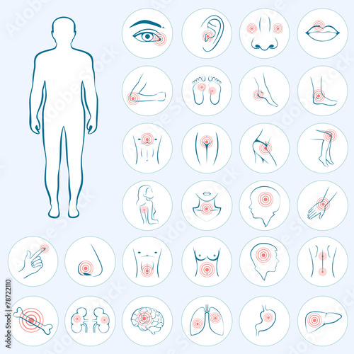 vector human anatomy, body pain, medical illustration