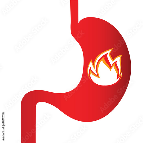 burning sensation in the stomach