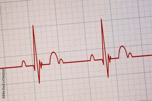 Obraz na plátně ECG / EKG monitor