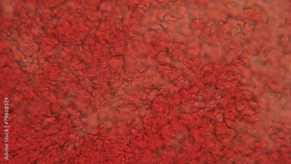 Blood Platelets Magnified 400x Blood Platelets Magnified 400x