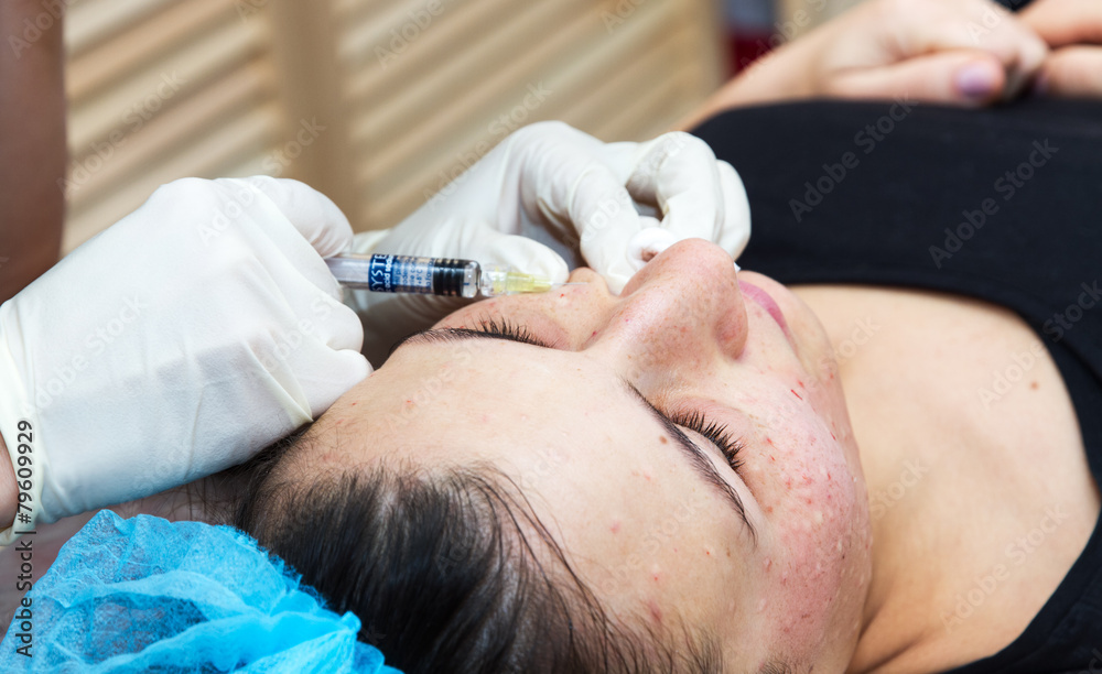 Injections on the face with cosmetic procedures. Injections on the face with cosmetic procedures.