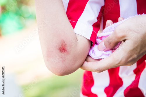 Young Child With bleeding arm wound near elbow