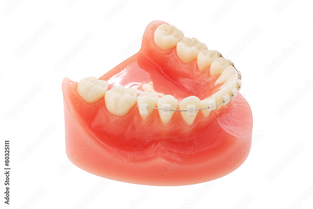 Obraz premium 入れ歯 Dentures