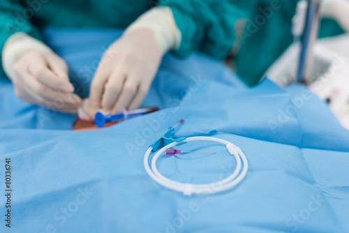 doctor apply guide wire to internal carotid vein