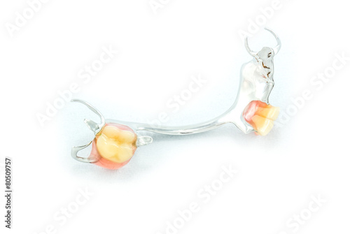 Metal base partial denture