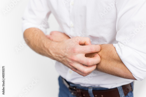 Young man having itchy and dry skin problem photo