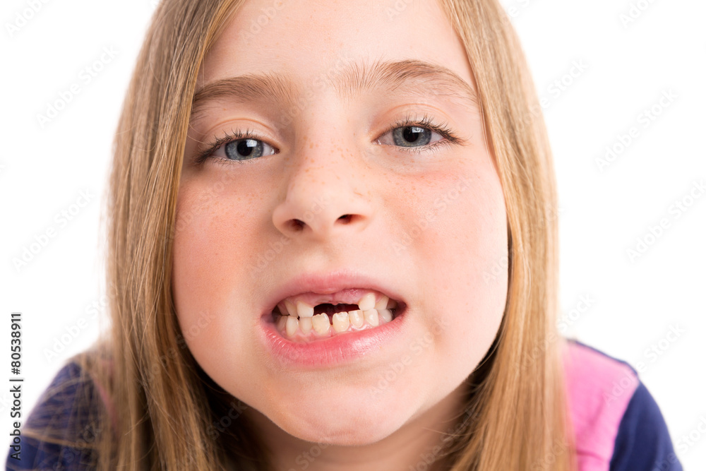 Blond indented girl showing teeth funny portrait Blond indented girl showing teeth funny portrait