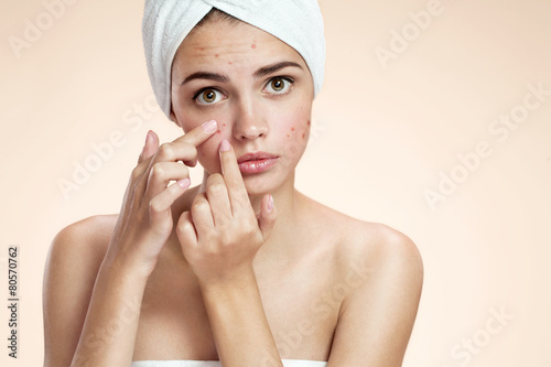 Acne spot pimple spot skincare beauty care girl