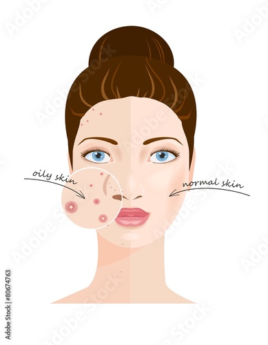 Skin types. Vector