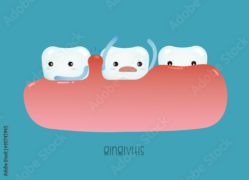 Gingivitis of dental vector