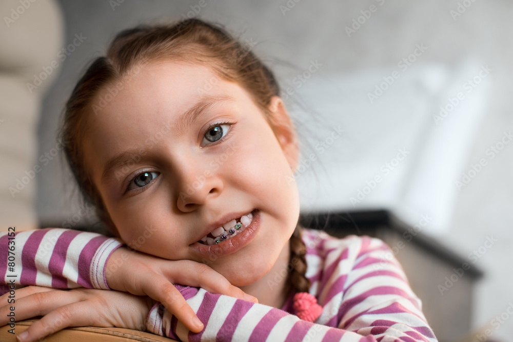 Girl with dental braces Girl with dental braces
