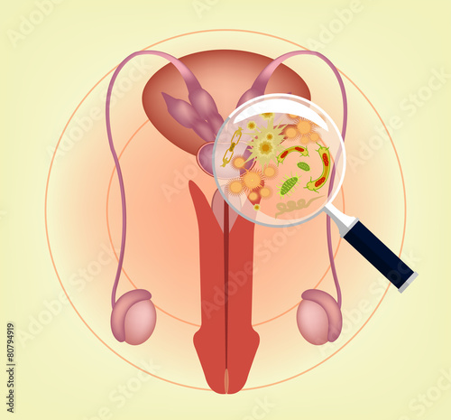 Male ill reproductive system with magnifier. Vector illustration