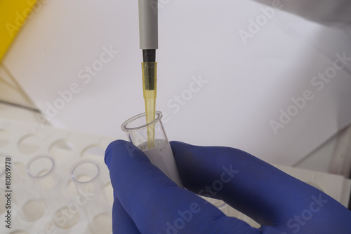 laboratory for analysys - blood test photo