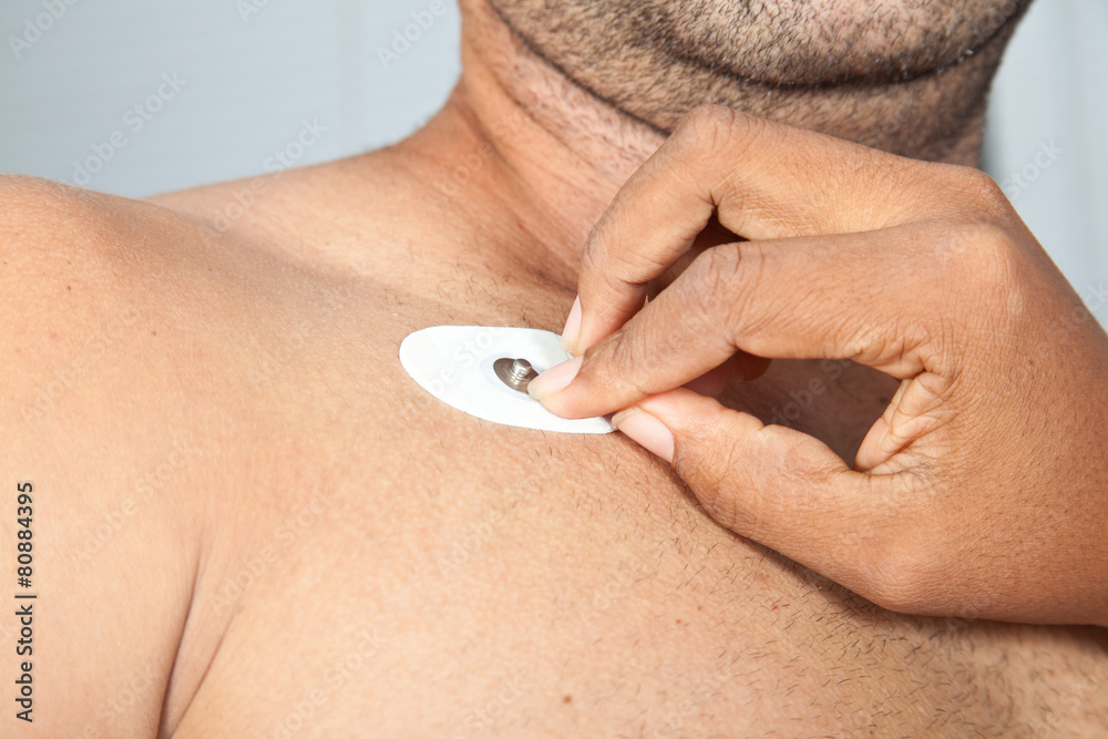 Fototapeta premium Acercamiento de las manos de una enfermera durante la colocación electrodos a un paciente para llevar a cabo un electrocardiograma